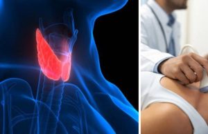 ¿Cuáles son los primeros síntomas del cáncer de tiroides que han padecido Arelys Henao y Andrea Serna?