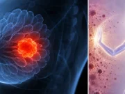 Picazón persistente en el pezón: la señal poco conocida que puede aparecer meses antes de un diagnóstico de cáncer de mama