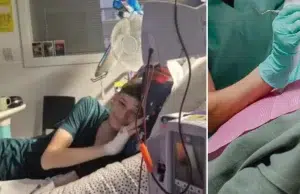 Joven de 19 años fue al odontólogo por un dolor de muelas y terminó en el hospital con diagnóstico de cáncer de sangre: ‘Pensé que era una infección’