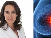 La advertencia de Alexandra Henríquez, ginecóloga, sobre el cáncer de mama: ‘Una mala gestión de las emociones puede debilitar el sistema inmune’