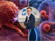 ‘Es una cifra alarmante’: experto advierte que al menos una de cada cinco personas tendrá algún tipo de cáncer; así puede prevenirlo