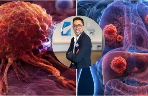 ‘Es una cifra alarmante’: experto advierte que al menos una de cada cinco personas tendrá algún tipo de cáncer; así puede prevenirlo