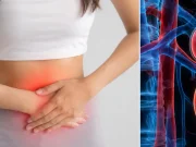 Mujer de 46 años acudió al médico por un dolor abdominal y descubrieron que nació con un solo riñón: ‘Nunca he tenido problemas renales’