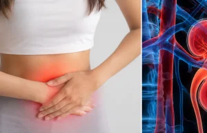 Mujer de 46 años acudió al médico por un dolor abdominal y descubrieron que nació con un solo riñón: ‘Nunca he tenido problemas renales’