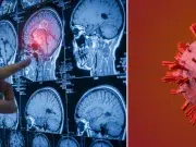 El cáncer cerebral puede empezar así: cinco señales tempranas que suelen pasar desapercibidas antes del diagnóstico
