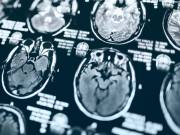 Científicos identifican el circuito cerebral que define si seguimos un plan fallido o cambiamos de estrategia