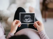 Estudio advierte que la infertilidad en mujeres de 35 a 49 años sigue en aumento y podría afectar a casi 80 millones en 2036
