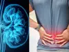 ¿Cómo reconocer los primeros síntomas de una enfermedad en los riñones y cuándo consultar al médico?