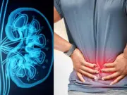 ¿Cómo reconocer los primeros síntomas de una enfermedad en los riñones y cuándo consultar al médico?