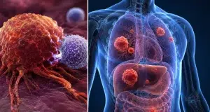 Más del 90 % de la población mundial se verá afectada de alguna forma por el cáncer, según las investigaciones avaladas por la OMS