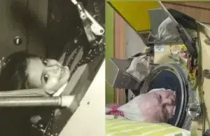 Muere Martha Lillard, la última paciente de polio de EE.UU. que usaba un pulmón de acero