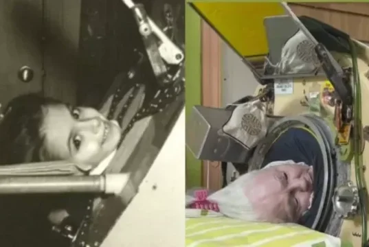 Muere Martha Lillard, la última paciente de polio de EE.UU. que usaba un pulmón de acero