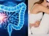 Cáncer de colon en mujeres: siete síntomas que pueden confundirse con la menstruación, según estudios