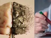 ¿Se puede detectar el Alzheimer antes de que aparezca? Un análisis de sangre abre una nueva esperanza