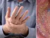 Salud bucal: el vínculo inesperado entre la microbiota oral y la artritis en las manos, según estudio chino