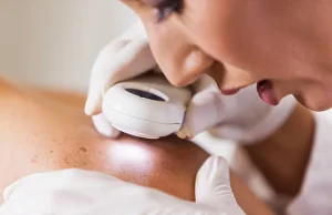 Moderna y Merck anuncian resultados positivos de una vacuna contra el cáncer de piel