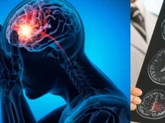 La compañía colombiana que utiliza inteligencia artificial para prevenir infartos, ACV y otras emergencias cardiovasculares
