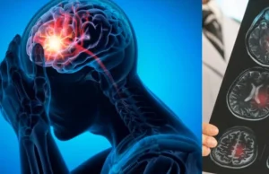 La compañía colombiana que utiliza inteligencia artificial para prevenir infartos, ACV y otras emergencias cardiovasculares