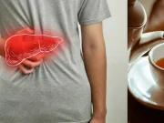 Hígado graso: seis bebidas naturales para tomar en ayunas y hábitos que ayudan a cuidarlo
