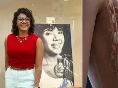 Mujer de 29 años llevaba una vida saludable, pero un bulto llamó su atención: ‘El doctor me dijo que por mi edad no era nada malo, resultó ser cáncer’